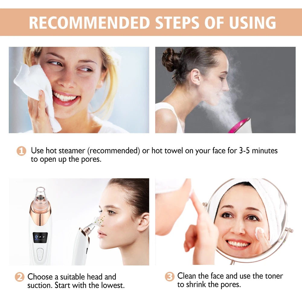 Adkartz™ Vacuum Blackhead Remover