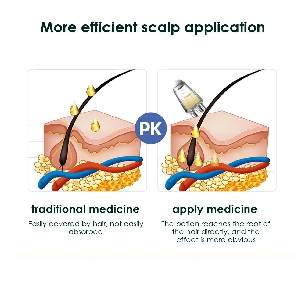 Adkartz™ Scalp Hair Oil Applicator
