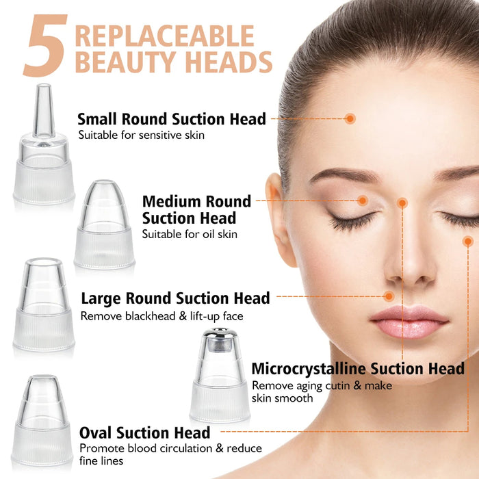 Adkartz™ Vacuum Blackhead Remover