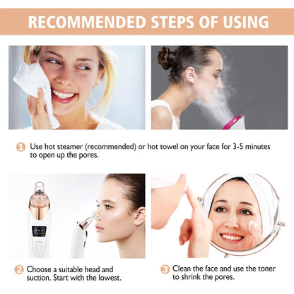 Adkartz™ Vacuum Blackhead Remover