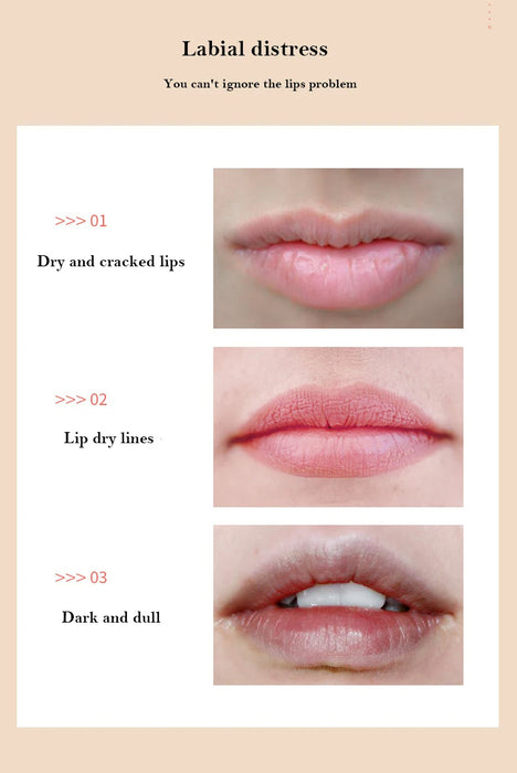 Adkartz™ Collagen Lip Mask