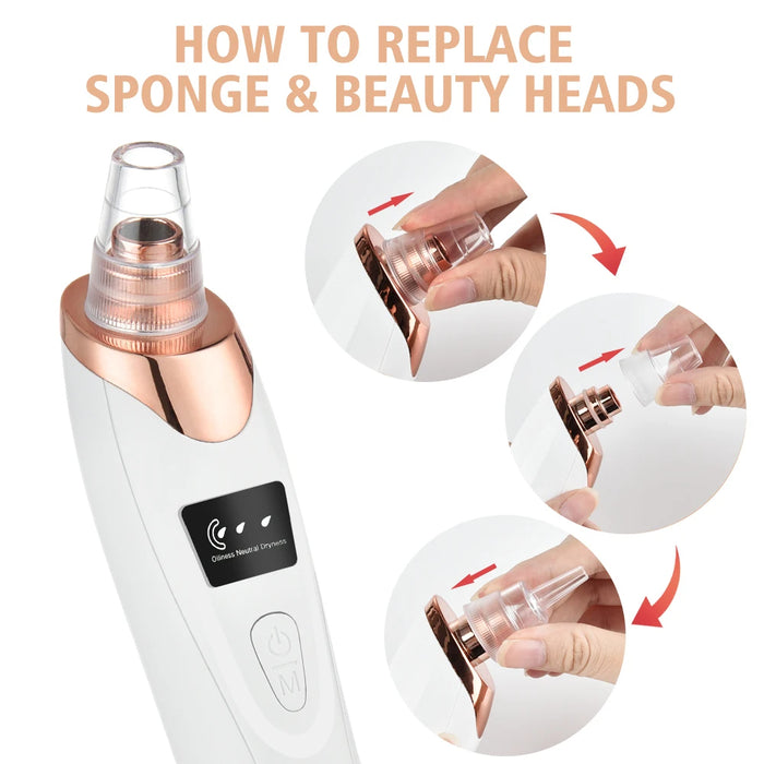 Adkartz™ Vacuum Blackhead Remover